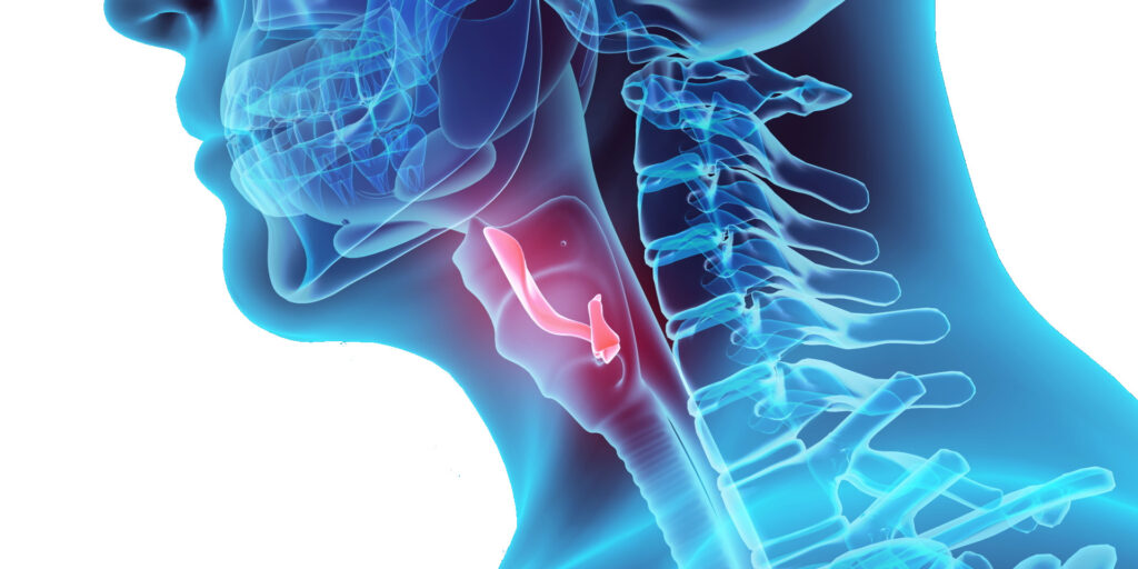 Autoimmune Thyroiditis